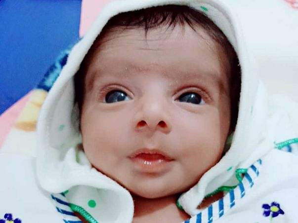 My 3 Months Daughter Is Struggling With Hydrocephalus, Help Her.