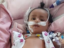 8 Months Old Mintu Needs Your Help Fight HLM secondary