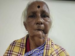 Help Siddagagamma Recover From Carcinoma Buccal Mucosa