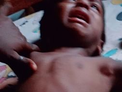 Support Sidharth To Undergo Surgery For Imperforate Anus By Birth