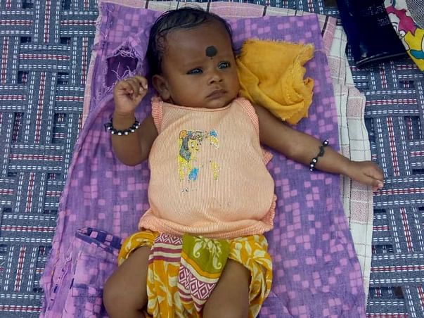1 Month Old Baby Of Bhagyalakshmi Needs Your Help Fight Congenital Umbilical Hernia