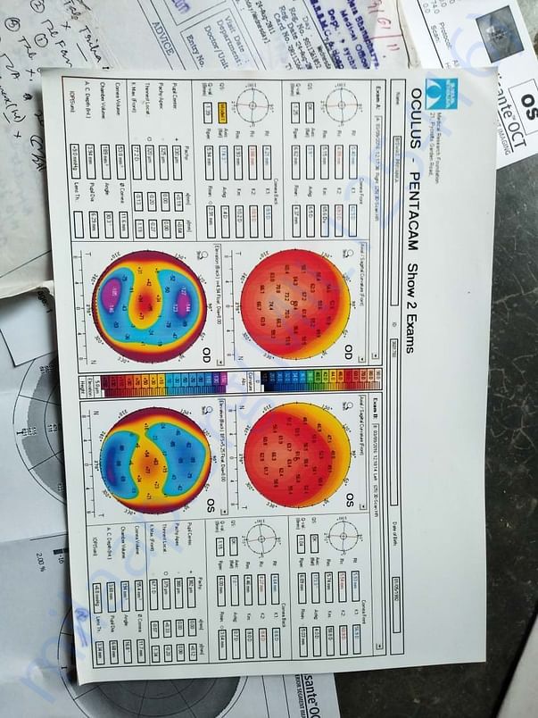 Need money for medical eyes problem report