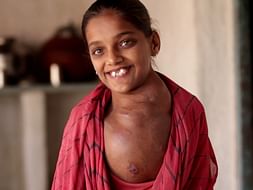 Help Girl with crippling tumour on neck