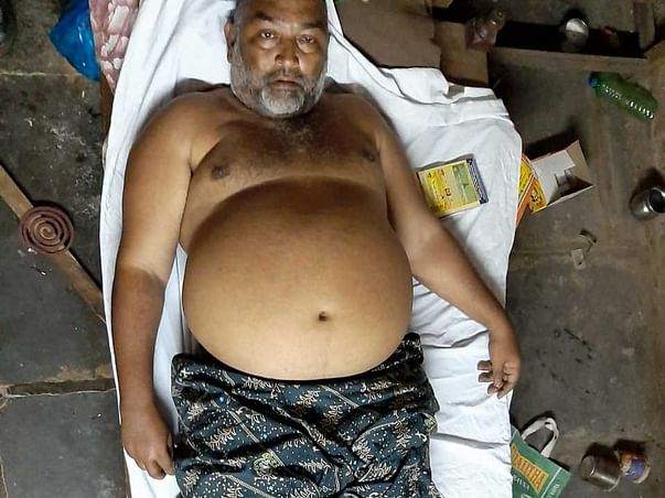 Need Support For Vijay Kumar, He Is Suffering Kidney And Filaria