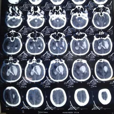 Medical Report