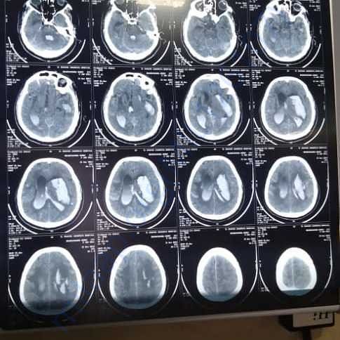 Medical Report