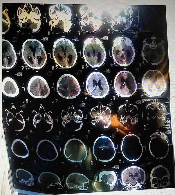 Xray