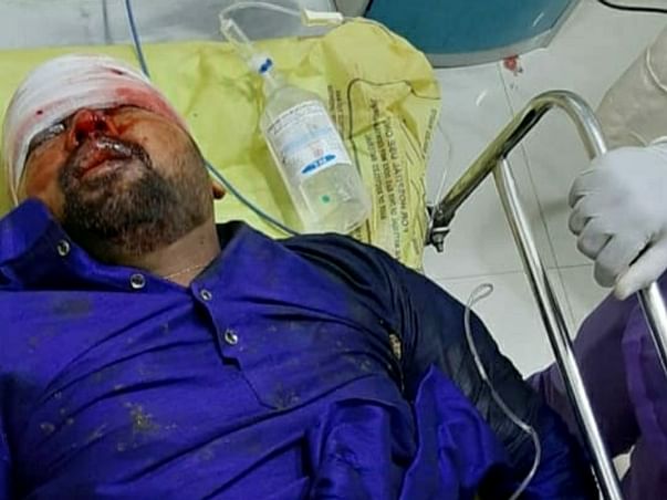 30 Years Old Bhaskar Rao Needs Your Help Fight Accident