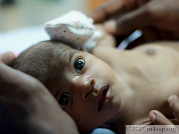 Help Divya's Baby Recover