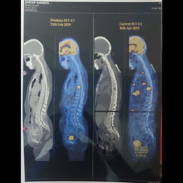 PET-CT SCAN DOCUMENT