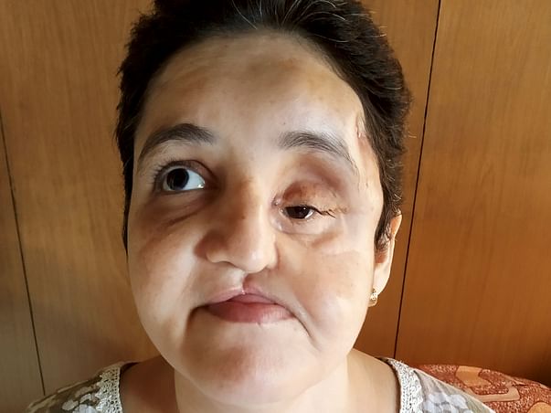 Help Nuzhat Fight Brain Tumor.