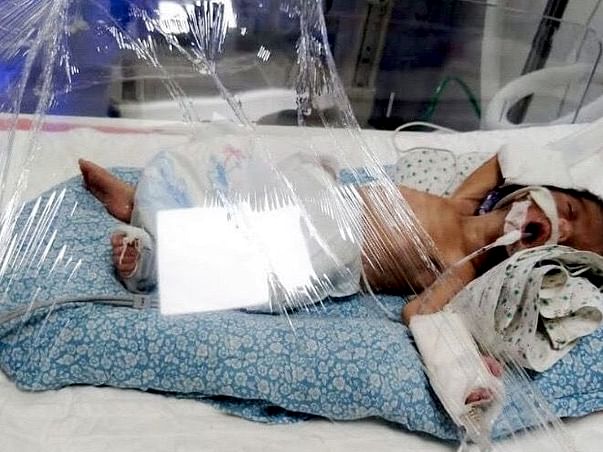 Help My Daughter Recover From Preterm Birth