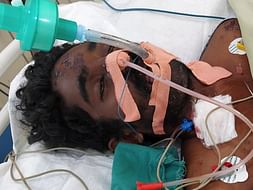 Support Amal Sankar Recover From Liver Failure