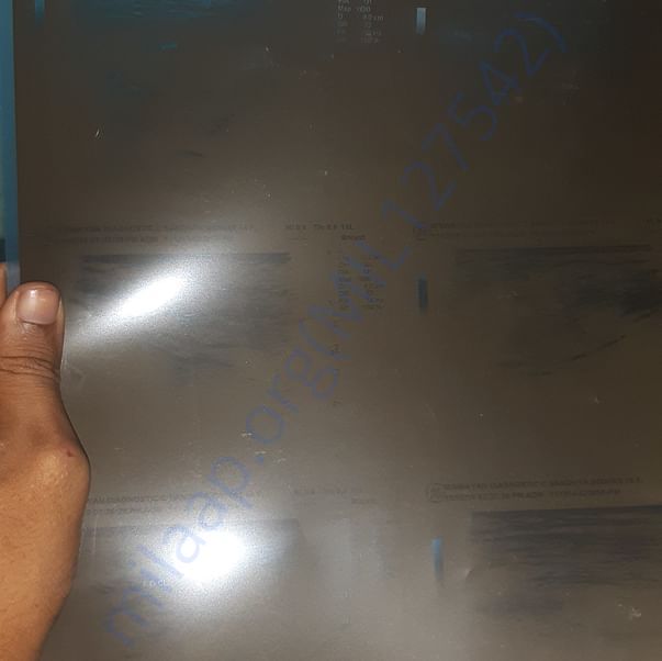 X ray report of my mother