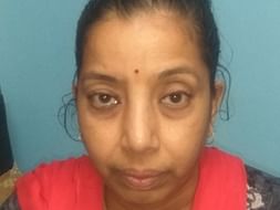 This 51 years old needs your urgent support in fighting Breast cancer
