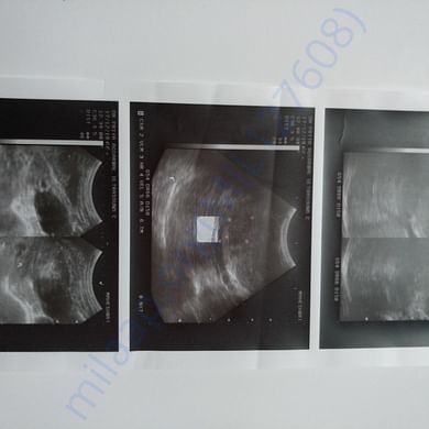 Medical Report