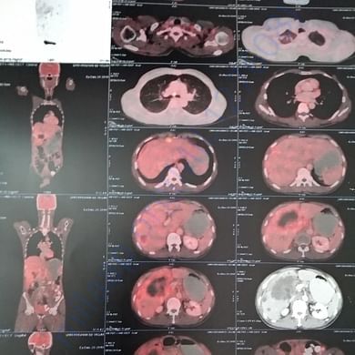 Medical Report