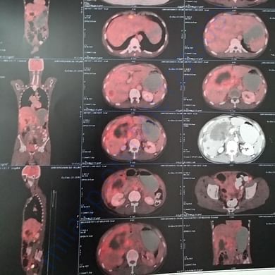 Medical Report