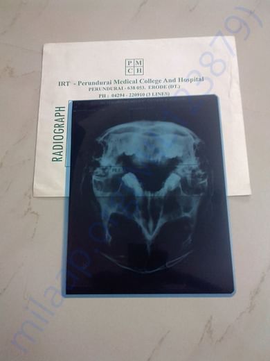 Scan report