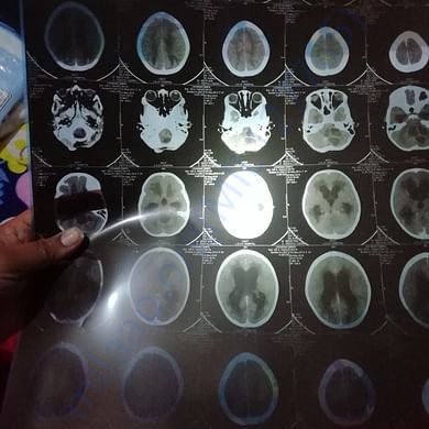 Medical Report