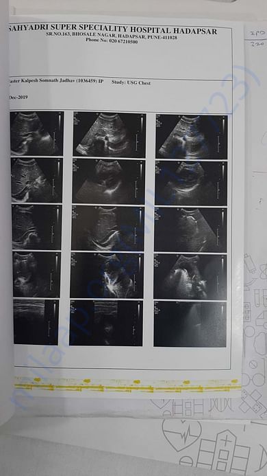 X-RAY