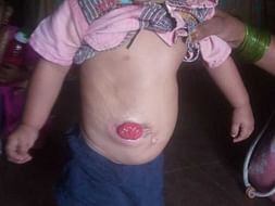 My Friend Son Is Struggling With Stomach Diseases, Help Him