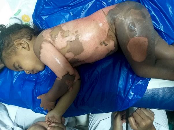 Help Raasya to undergo plastic surgery