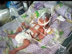 Please Donate Funds For Premature Baby And Save Her Life