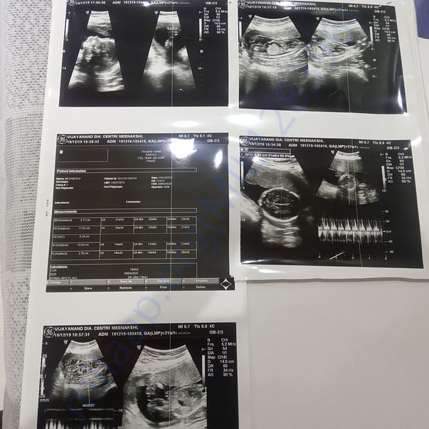 Level 2 scan