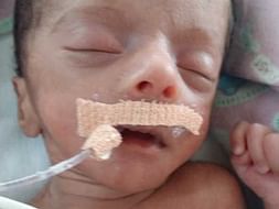 Support New Born Baby Recover From Breathing Problems