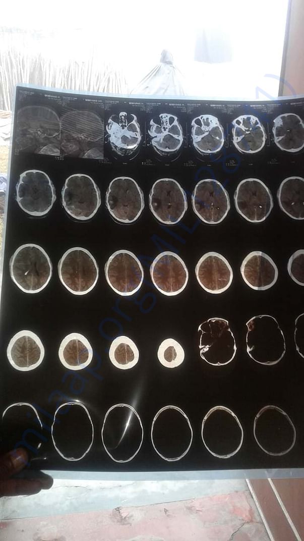 Medical Xray