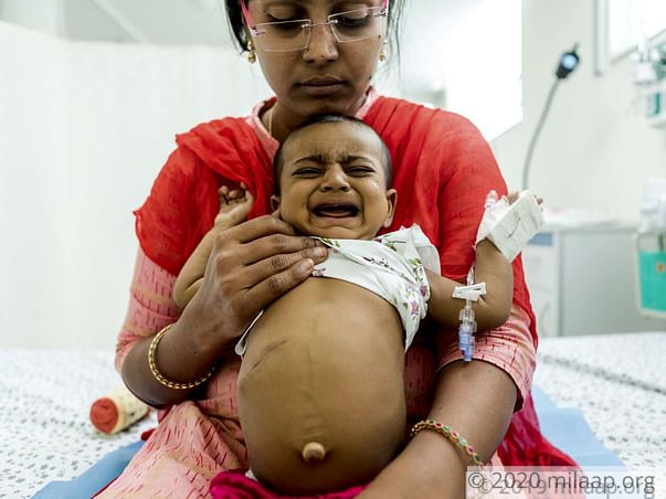 Johanty needs a liver transplant surgery and he needs it urgently