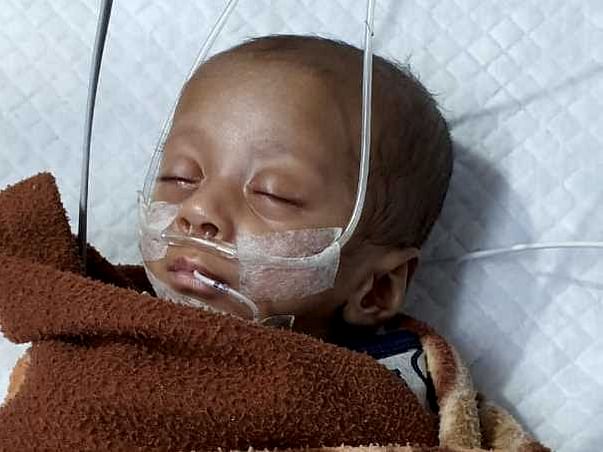 4 Months Old Eshaan Needs Your Help Fight Retinopathy Of Prematurity