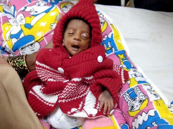 20 Days Old Baby Of Anjali Needs Your Help To Undergo NICU Care.