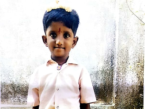 Save 9 Yrs Santhana Karthicka From Pulmonary Atresia
