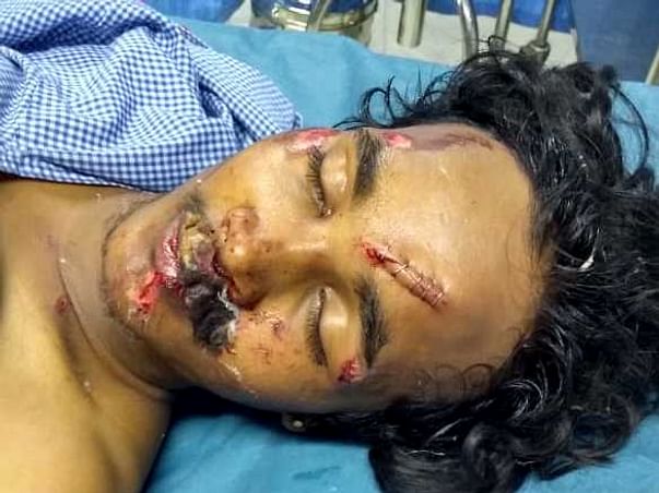 Help Tarun Recover
