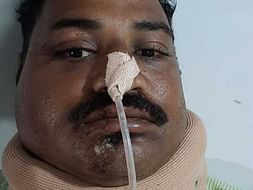 32 years old Prashant Rajpurkar needelp fight Multiple Skull Fractures
