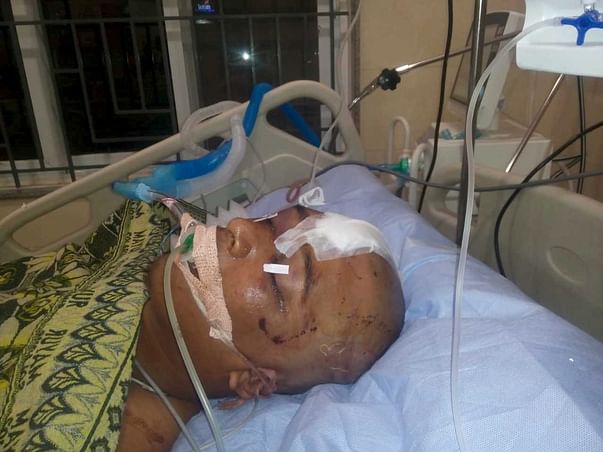 Support Five Rose Recover From Accident