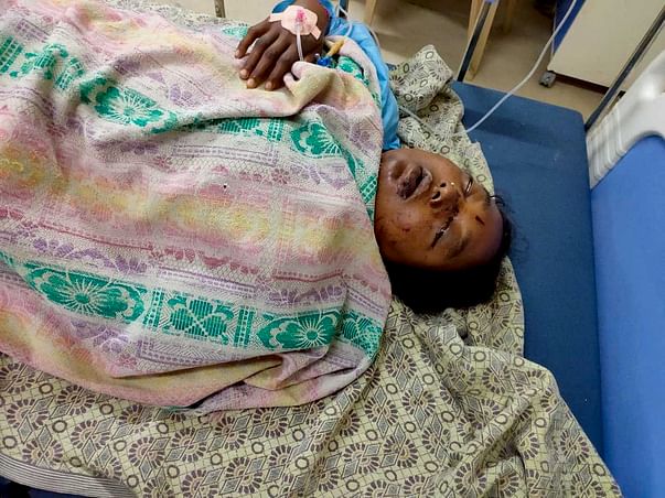 Support Ponnam Sarojana Recover From Accident