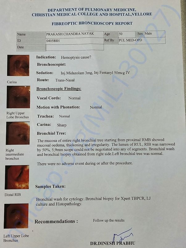 Fibreoptic Bronchoscopy Report