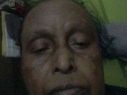 Help my mother Parul Roy fight breast cancer