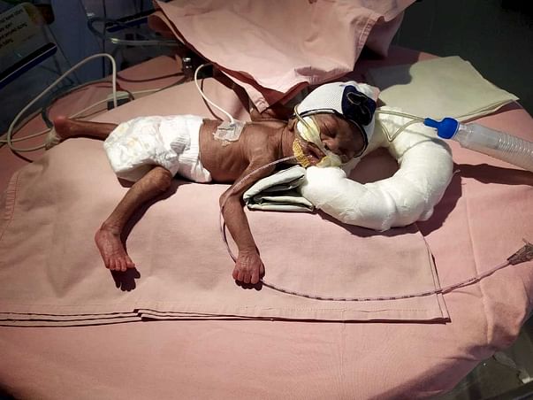 NICU சிகிச்சைக்கு உட்படுத்த மோகனா பிரியாவின் குழந்தையை ஆதரிக்கவும்