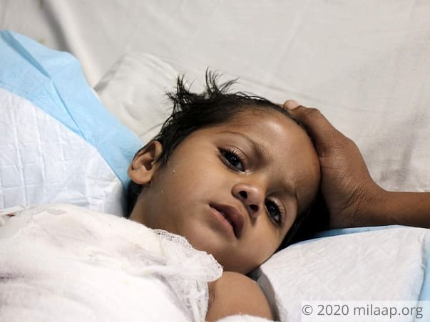 1-Year-Old Fell Into Boiling Hot Water, Suffered Severe Burns