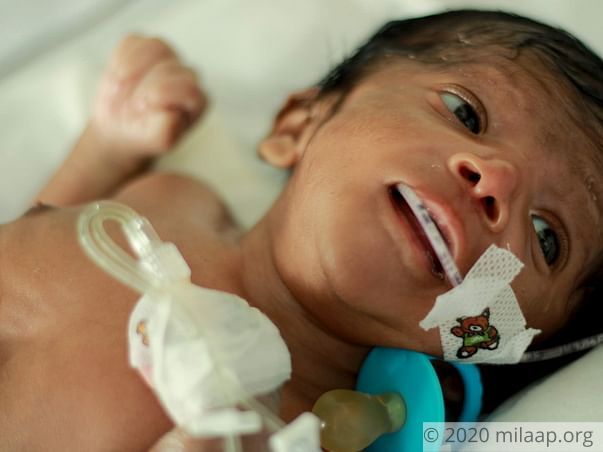 Balamurugan is struggling for his life in the ICU and need your help