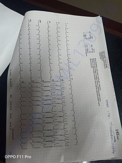 ECG report