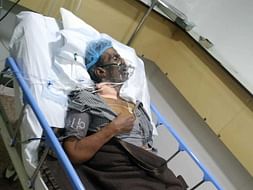 Support Sagayaraj Undergo Liver Transplant