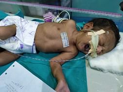 Help My Nephew Recover From Brain Tumor