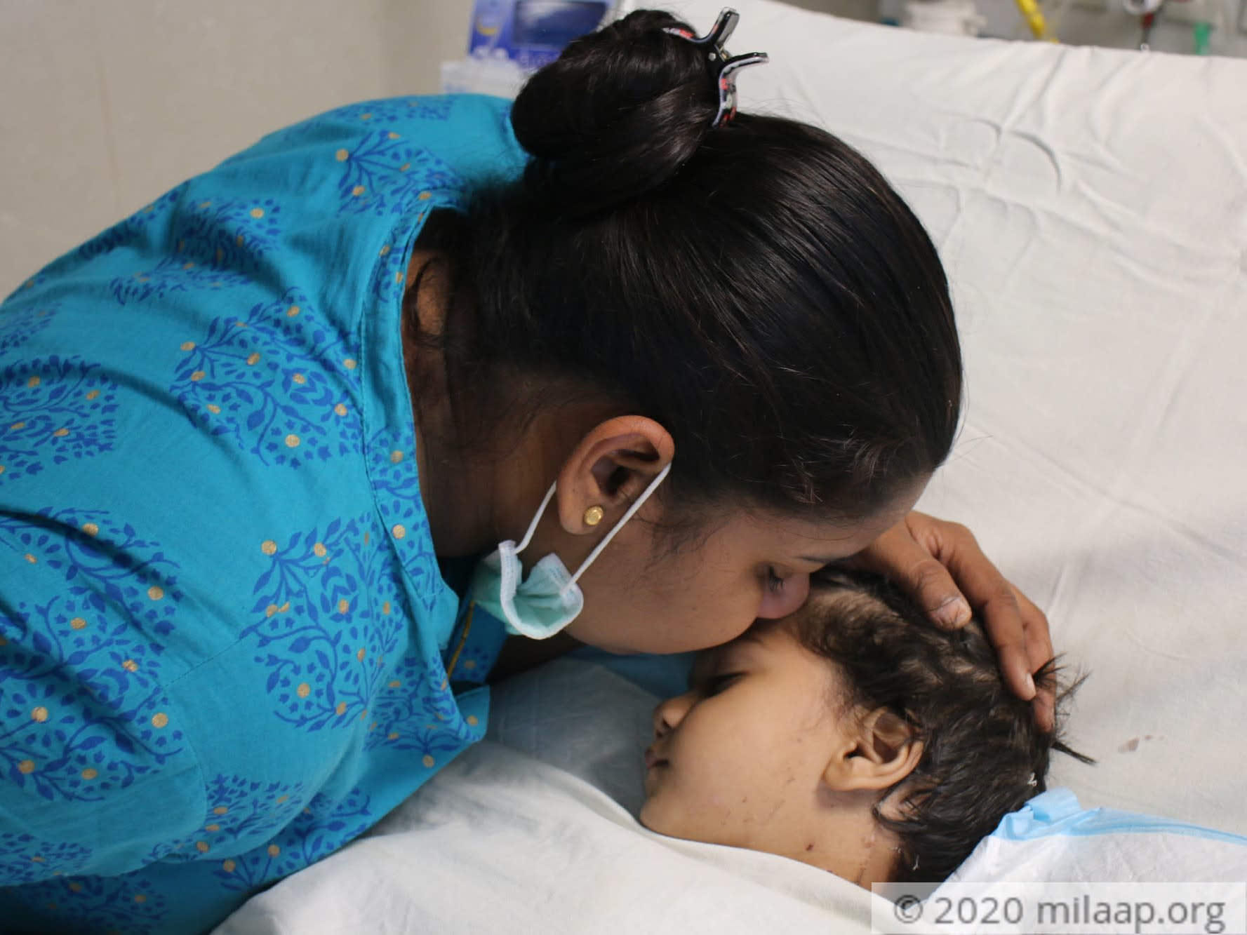 1 Year Old Fell Into Boiling Hot Water Suffered Severe Burns All Over Her Body Milaap Discover images and videos about hot girls from all over the world on we heart it. suffered severe burns all over her body