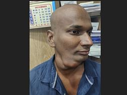31 Years Old J. Arun Needs Your Help To Fight Tongue Cancer