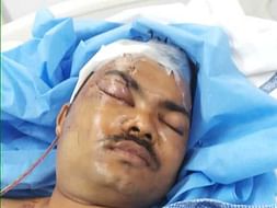 Support Vikas Rao Chapdi Recover From Road accident